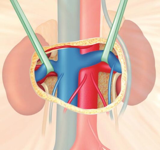 Fig. 3 B. Control vascular renal