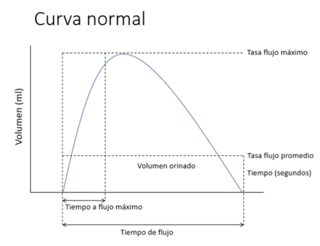 Fig. 1. Curva Normal de Uroflujometría.