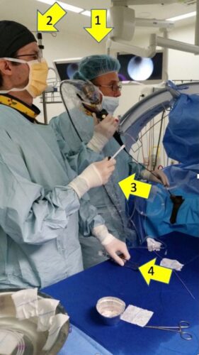 Fig. 9 Endourólogos: 1. Primer cirujano 2. Segundo cirujano  3. Manipulación de canastillo 4. Bomba de irrigación manual