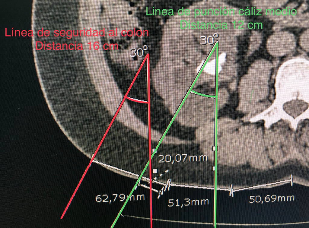 Fig.1 Medidas Antropométricas