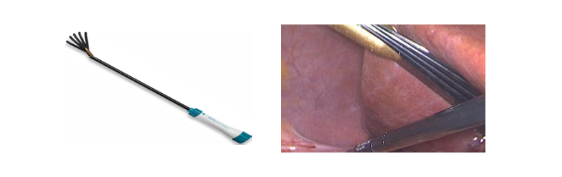 Fig. 10. Separador articulado “Endoretractor IIR”.