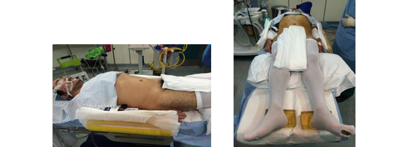 Fig. 2. Posición de Cirugía Pélvica