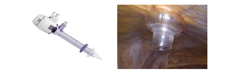 Fig. 9 Trócares transparentes romos, con mecanismos de auto retención.